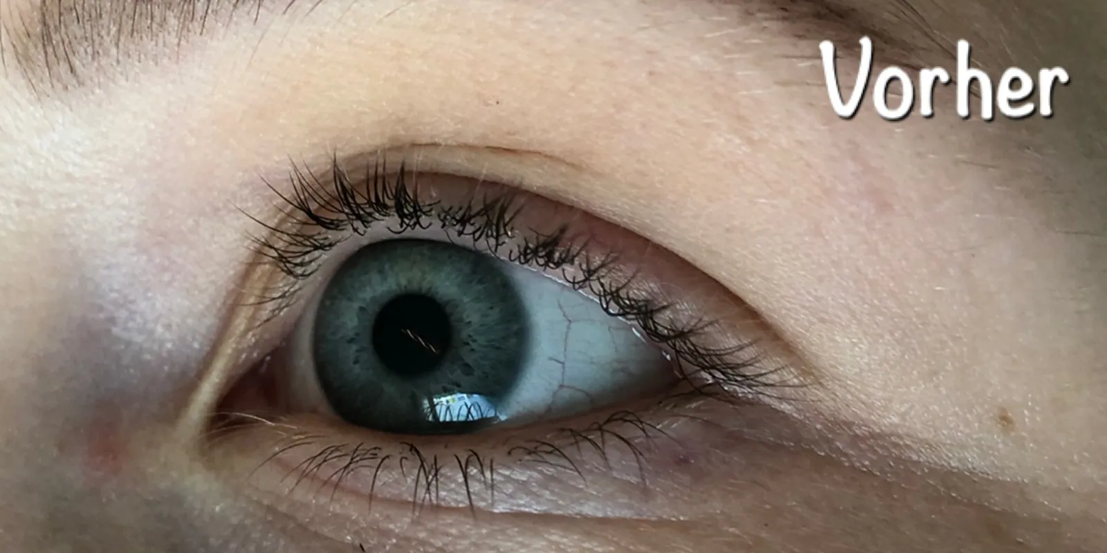 Wimpernlifting vorher