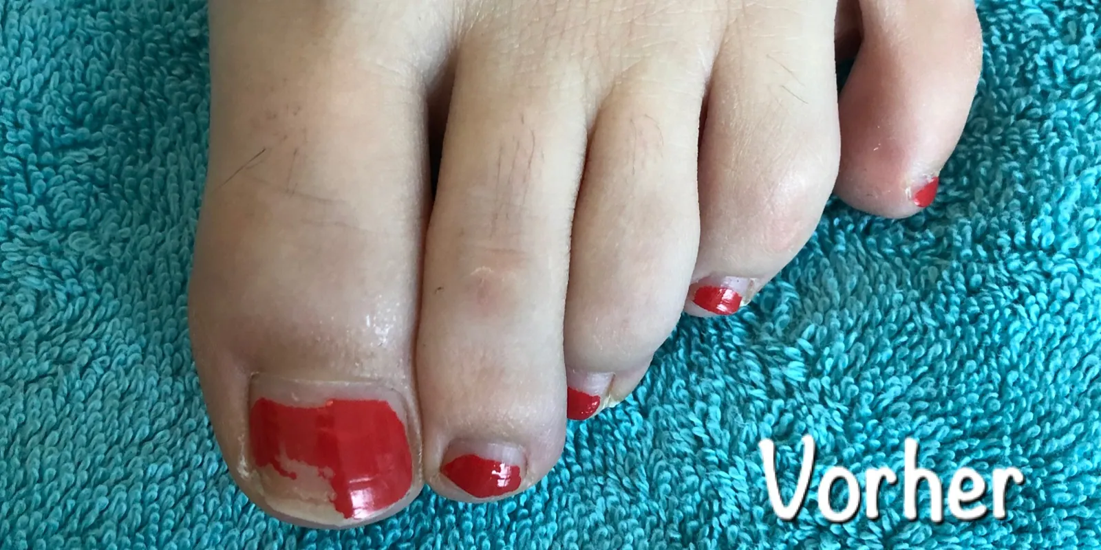 Pedicure mit Lack vorher